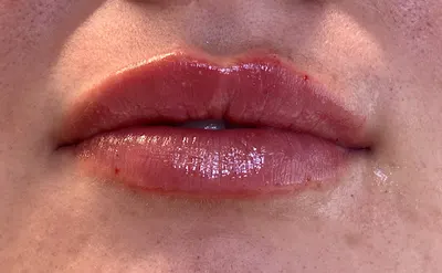 Lek Emilia Bąk medycyna estetyczna